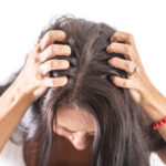 頭皮トラブルの5つの原因｜痒みやフケを抑えるケア方法を美容師が解説