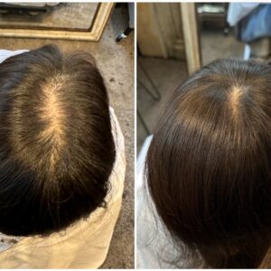 [2024]流行りのヘッドスパで育毛＆発毛効果はあるのか？